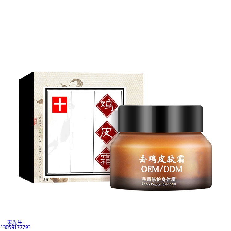 圣安多尼堂区_去鸡皮肤毛刺毛角周滋润修复保湿身体霜