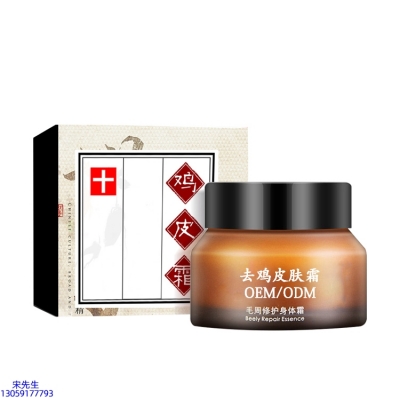 圣安多尼堂区_去鸡皮肤毛刺毛角周滋润修复保湿身体霜
